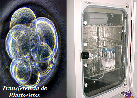 Transferencia de Blastocistos