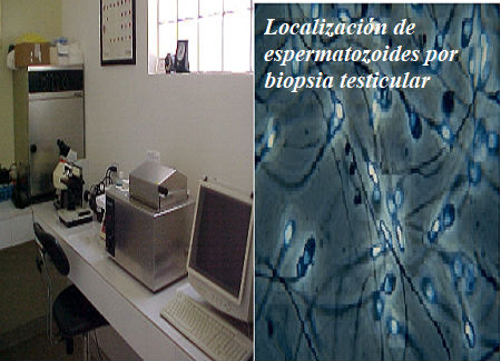 Localización de espermatozoides por biopsia testicular